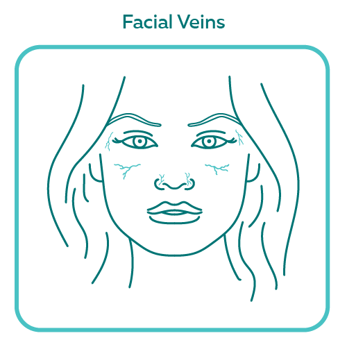 Facial Veins illustration with border