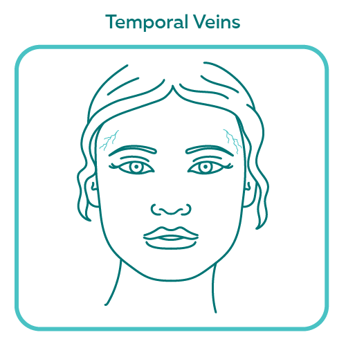 Temporal Veins illustration with border