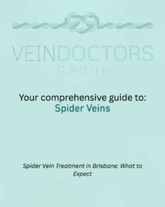spider vein treatment Brisbane