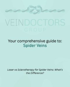 spider vein treatment