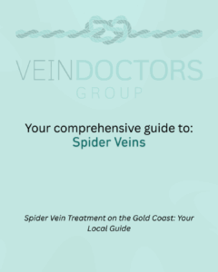spider vein treatment Gold Coast