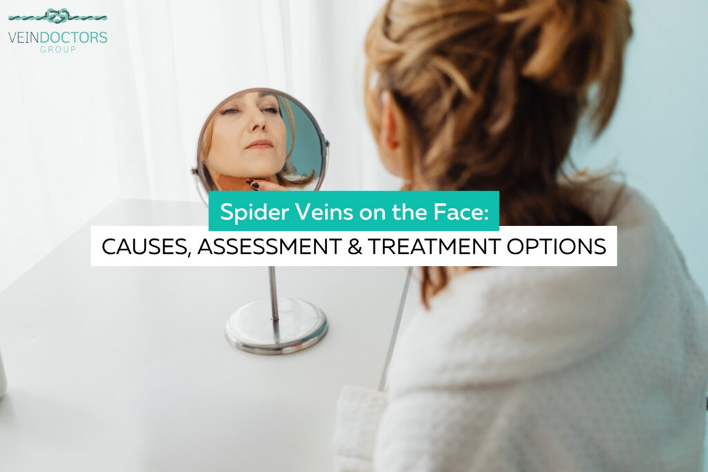 Spider veins on face assessment