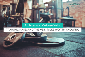 Athlete veins vs varicose veins